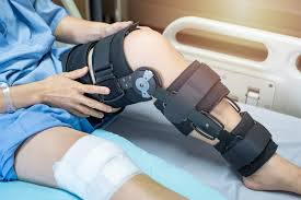 gait analysis
